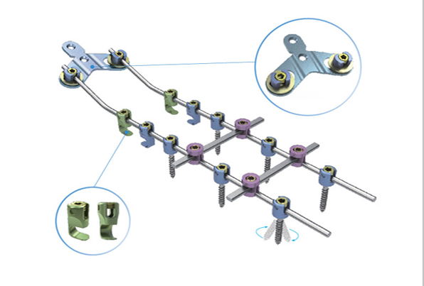 Posterior Cervical Screw System